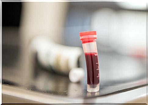 Sample of a blood test.