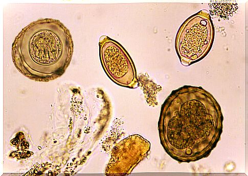 Helminth egg in feces seen under the microscope.